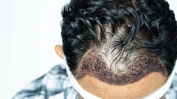 AVS PLASTIC SURGERY AND SKIN CLINIC Pudukkottai